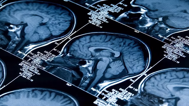 Close-up view of brain highlighting amygdala, hippocampus, and prefrontal cortex