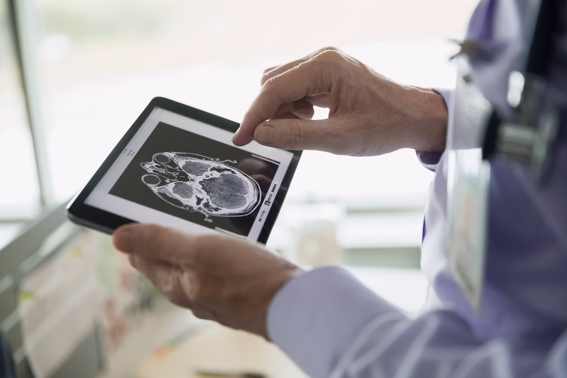Brain Scan TMS Doctor Brain Scan TMS Doctor